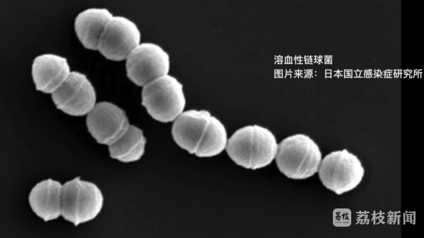 星速配资 正在日本流行的“食人菌”是什么？如何预防？